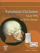 Image of functional occlusion from tmj to smile design