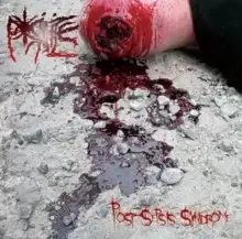 Image of Post-sepsis Syndrome