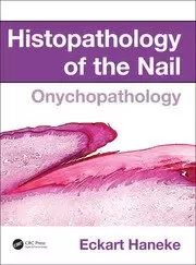 Image of Histopathology of the Nail Onychopathology
