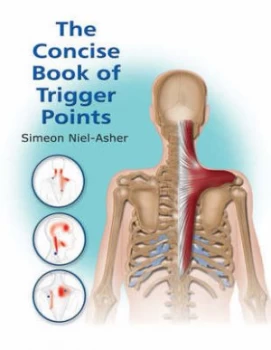 Image of The Concise Book of Trigger Points by Simeon Niel-Asher Paperback