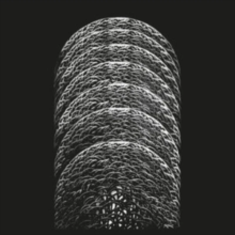 Image of The Warren Vinyl