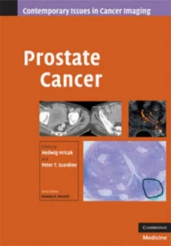 Image of Prostate Cancer by Hedvig Hricak Hardback