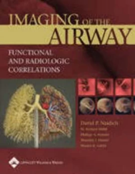 Image of Imaging of the Airways by David P. Naidich Hardback