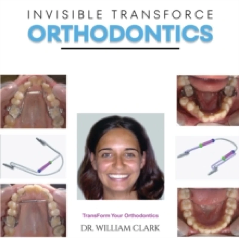 Image of Invisible TransForce Orthodontics Paperback / softback