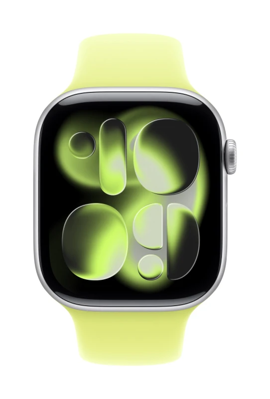 Image of Apple Apple 46mm Neon Yellow Sport Band - S/M MFGV4ZM/A