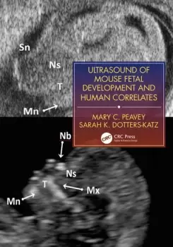 Image of Ultrasound of Mouse Fetal Development and Human Correlates
