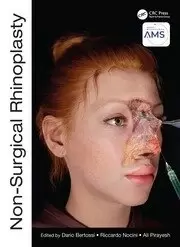Image of Non-Surgical Rhinoplasty