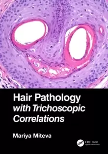 Image of Hair Pathology with Trichoscopic Correlations