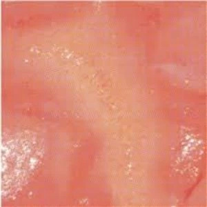 Image of KL&Auml;MP &ndash; Hate You Vinyl