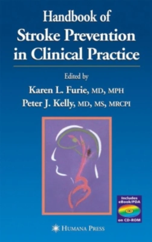 Image of Handbook of Stroke Prevention in Clinical Practice Hardback