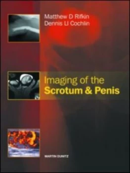 Image of Imaging of the Scrotum and Penis by Matthew Rifkin Hardback