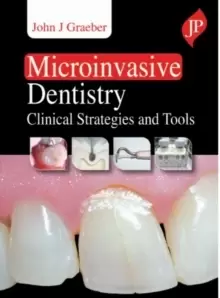 Image of Microinvasive Dentistry : Clinical Strategies and Tools