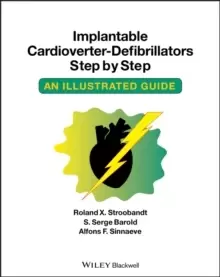 Image of Implantable Cardioverter - Defibrillators Step by Step : An Illustrated Guide