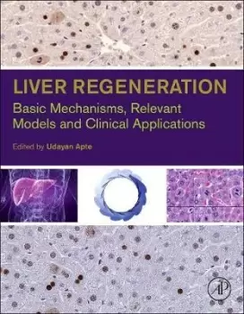 Image of Liver Regeneration by Udayan M. Apte