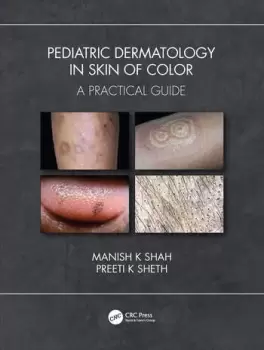 Image of Pediatric Dermatology in Skin of ColorA Practical Guide