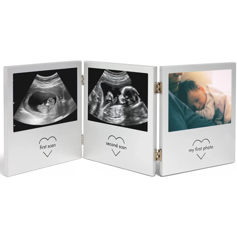 Image of VonHaus Vonhaus - Baby Scan Photo Frame, Multi-Photo Silver unisex one size