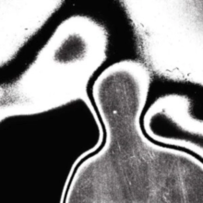 Image of Universal pressure Vinyl