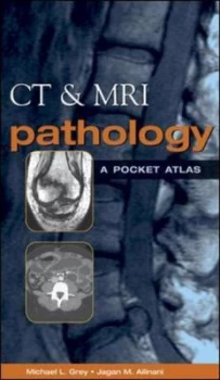 Image of Ct and Mri Pathology by Michael L Grey Paperback