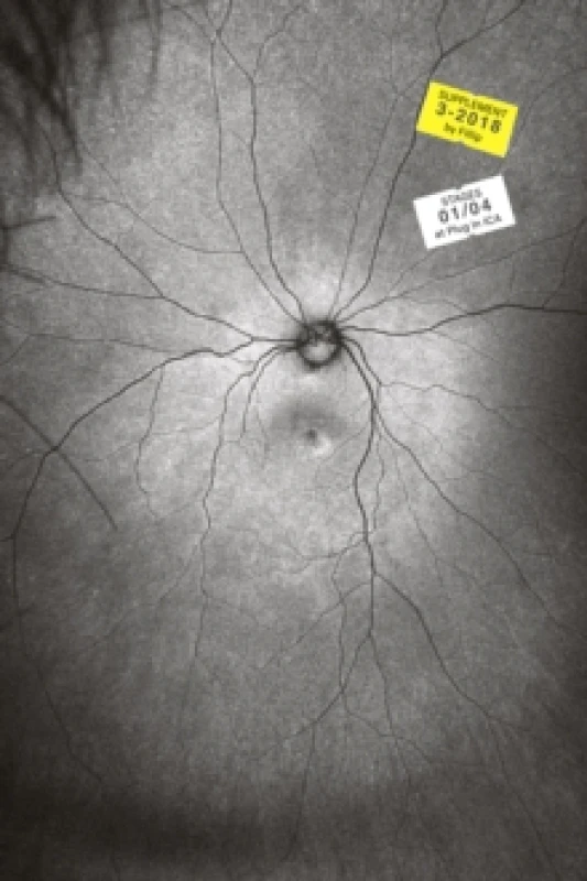 Image of Supplement 3: The Invention and Conclusion of the Eye Paperback / softback