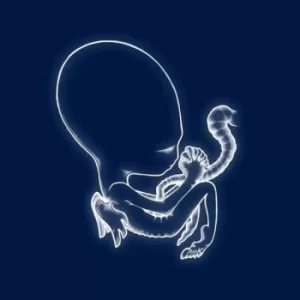 Image of Sigur Rós ‎- Ágaetis Byrjun Vinyl