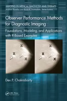 Image of Observer Performance Methods for Diagnostic ImagingFoundations Modeling and Applications with R-Based Examples