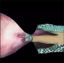 Image of Painted Shield 2