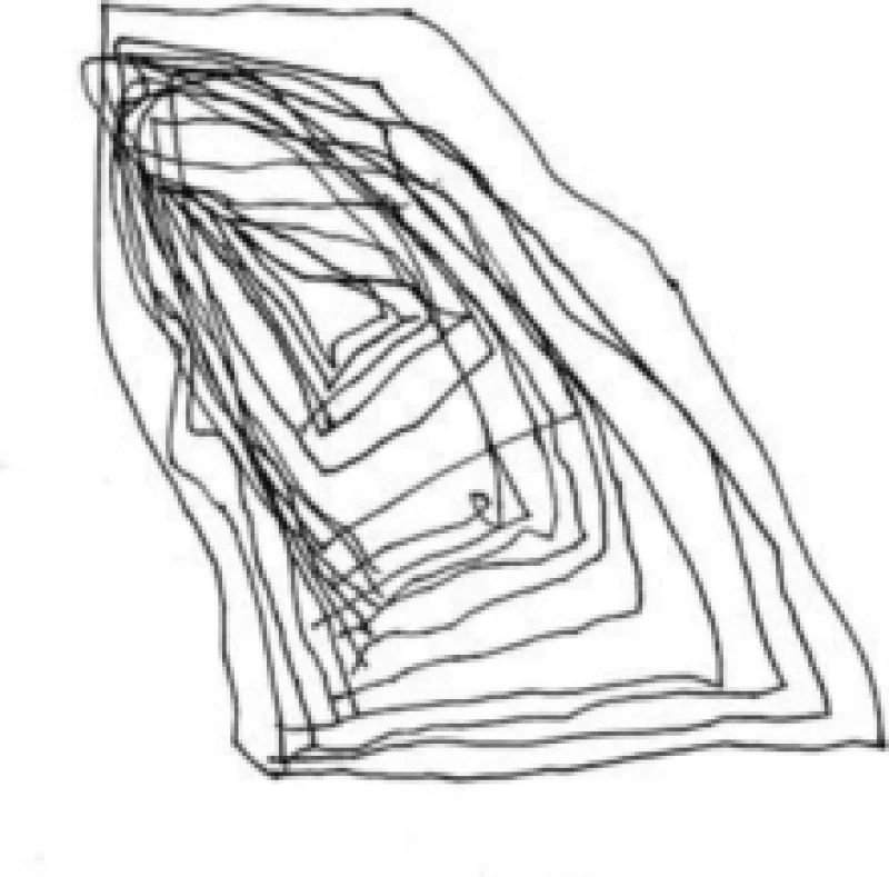 Image of My Only Secret Vinyl