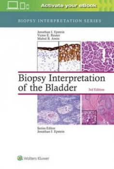 Image of Biopsy interpretation of the bladder by Jonathan I Epstein