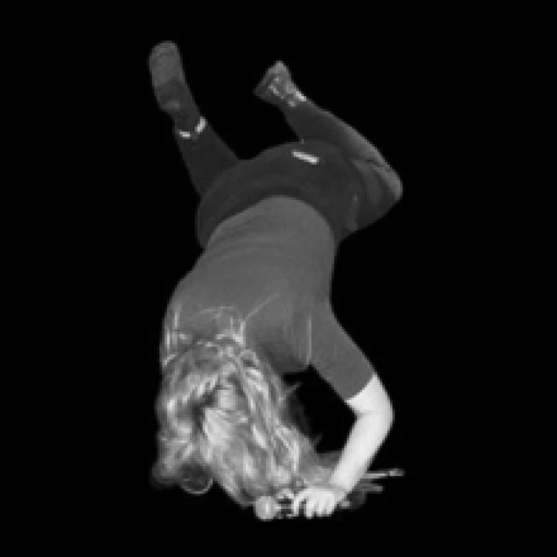 Image of Snake Chain Vinyl