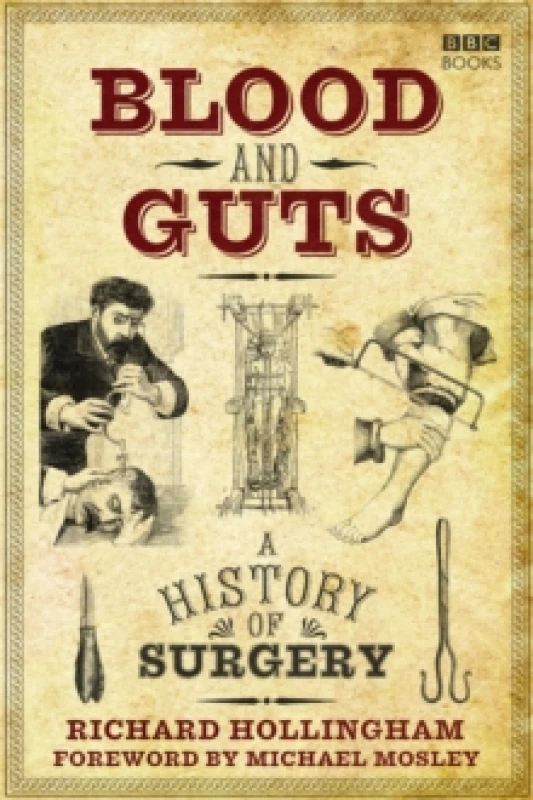 Image of Blood and Guts : A History of Surgery Paperback / softback