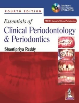 Image of Essentials of clinical periodontology and periodontics by Shantipriya Reddy