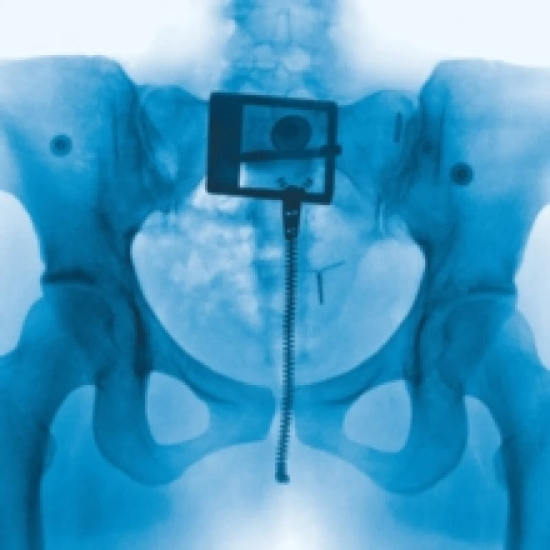 Image of Virgin (hmv Exclusive) Bathwater Vinyl Vinyl