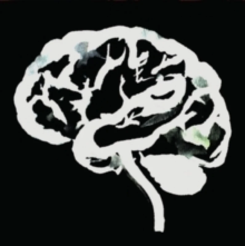 Image of Brain flakes Vinyl