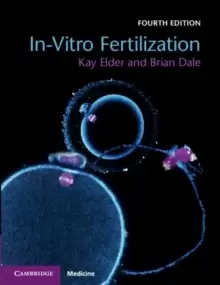 Image of In-Vitro Fertilization