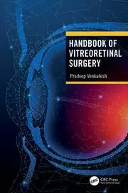 Image of Handbook of Vitreoretinal Surgery