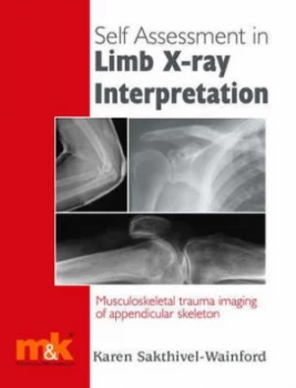 Image of Self-Assessment in Limb X-Ray Interpretation by Karen Sakthivel-Wainford Paperback