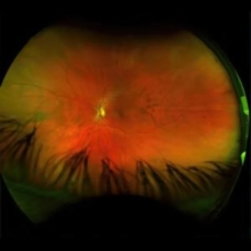 Image of Mirrorcell Vinyl