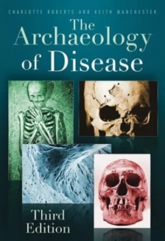 Image of The Archaeology of Disease by Charlotte Roberts Book