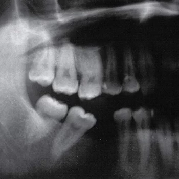 Image of Maenad Veyl - Onto Duat Vinyl